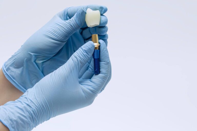 Can Autoimmune Conditions Affect Dental Implant Success?