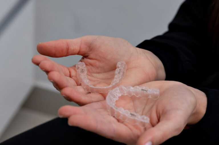 5 Things to Know Before Starting Clear Aligner Therapy clear aligners Panama City FL